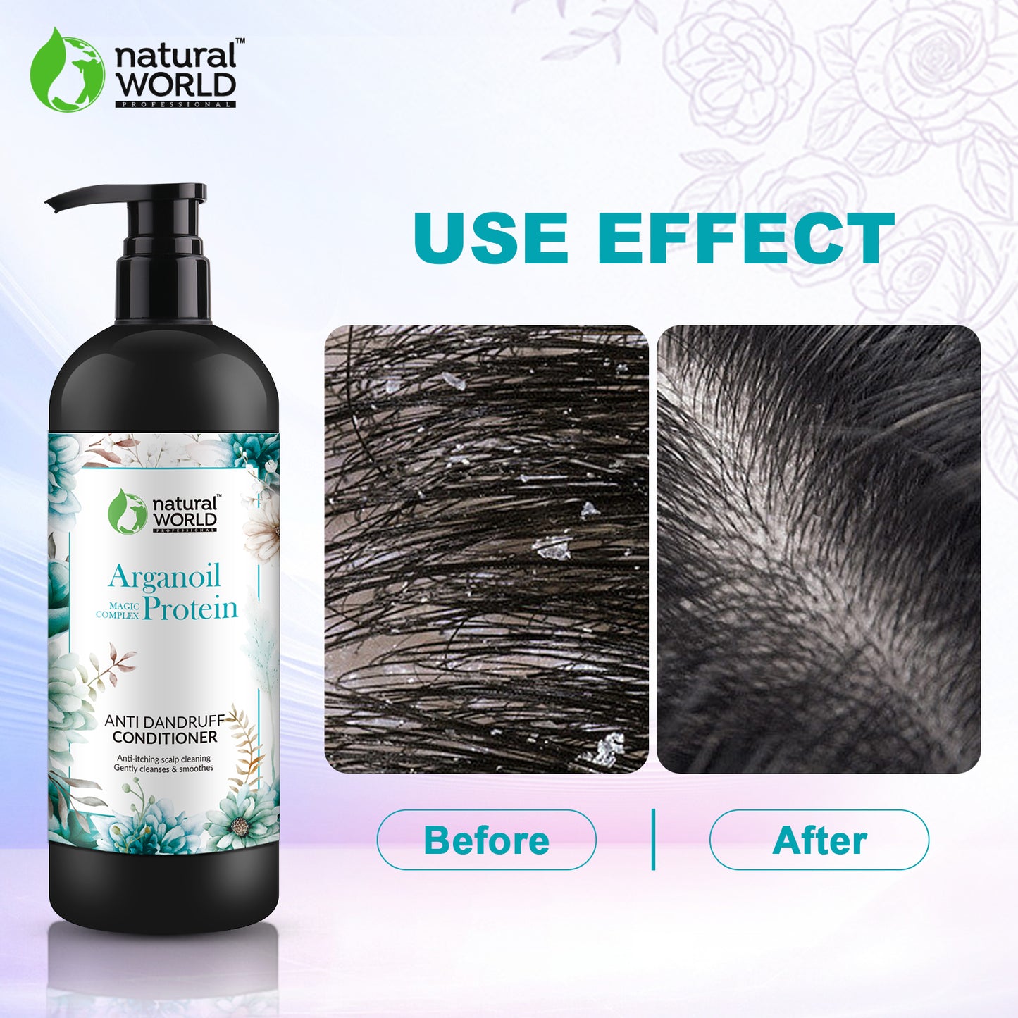 Anti Dandruff Conditioner