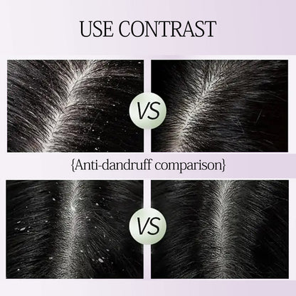 Anti dandruff shampoo and conditioner